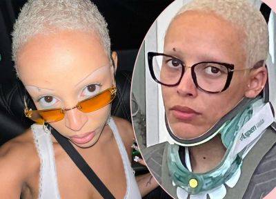 Doja Cat Responds To Concerned Fans After Posting Photo Of Herself In A NECK BRACE! - perezhilton.com