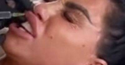 Katie Price weeps in pain as she gets lip fillers dissolved before showing off results - www.ok.co.uk - Britain