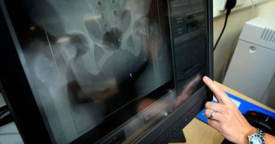 Radiography 'at breaking point' as one million people waiting for appointment - www.manchestereveningnews.co.uk