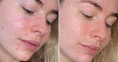 Shoppers rush to buy exfoliating toner that 'leaves skin glowing' with huge saving - www.ok.co.uk
