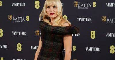 What is stress-related alopecia and how is it treated as Paloma Faith shares story - www.dailyrecord.co.uk - Britain