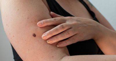 Five skin cancer symptoms you should look out for when checking your body - www.dailyrecord.co.uk - Britain