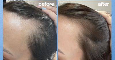 Shoppers swear by £29 'amazing' hair growth serum which gives 'thickening' results in 6 weeks - www.manchestereveningnews.co.uk
