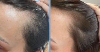 Shoppers love new hair growth serum that gives ‘double the amount of hair’ in 5 weeks - www.ok.co.uk