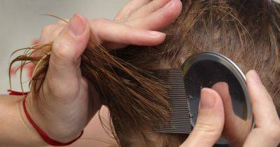 Pharmacist issues head lice warning over surge in cases 'due to hot weather' - www.dailyrecord.co.uk