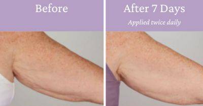 The £23 sagging arm cream that 'shows results in 7 days' giving shoppers confidence to wear short sleeves again this summer - www.manchestereveningnews.co.uk