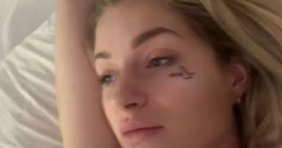 Lottie Moss gets face tattoo removed after drunkenly getting word inked below eye - www.ok.co.uk