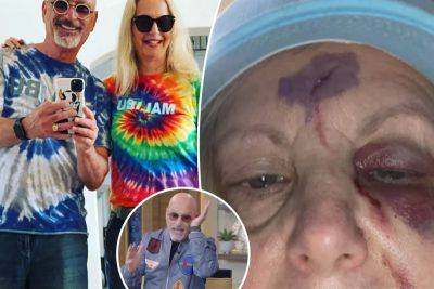 ‘America’s Got Talent’ judge Howie Mandel found his wife in pool of blood after drunken accident: ‘It was too much’ - nypost.com - Las Vegas - city Sin