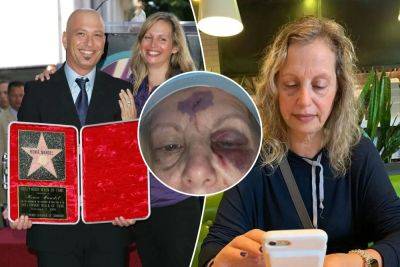 Howie Mandel says his wife wasn’t drunk in bloody fall at Vegas hotel — but here’s what she did take - nypost.com - city Sin