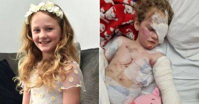 Brave dog mauling victim unrecognisable in pictures taken before and after attack - www.dailyrecord.co.uk - Scotland - Manchester - Hungary