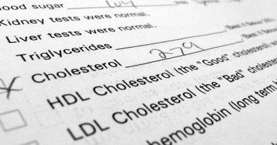 Doctor says stop eating these common food items to lower your cholesterol - www.dailyrecord.co.uk