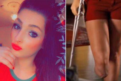 24-Year-Old Woman's Leg AMPUTATED After Getting Tiny Blister From Wearing Sneakers! - perezhilton.com - Britain
